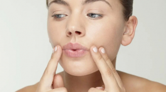 5 cách tự nhiên giúp giảm nếp nhăn khi cười, lấy lại làn da tươi trẻ