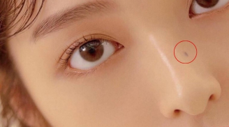 3 vị trí mọc nốt ruồi báo hiệu mệnh phú quý: Cả đời không lo thiếu tiền, càng lớn tuổi càng giàu sang