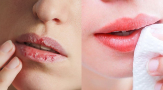Cách trị môi khô nứt nẻ bằng nguyên liệu sẵn có tại nhà để mùa đông khô hanh nhưng môi vẫn căng mọng