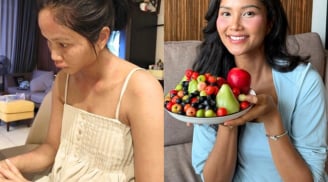 Tình trạng của H'Hen Niê sau khi mắc bệnh lạ sau sinh