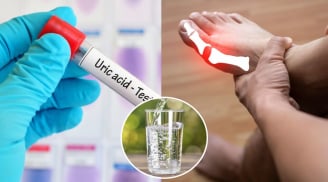 4 cách đào thải axit uric ra khỏi cơ thể nhanh chóng