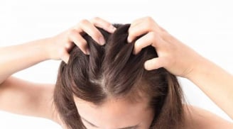 4 mẹo chăm sóc đơn giản nhưng cực hiệu quả giúp bạn “vượt qua mùa tóc bết” một cách nhẹ nhàng.