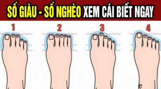 Nhìn tướng chân biết tương lai bạn thành phượng hoàng hay nô tì mãi mãi