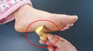 4 lợi ích tuyệt vời khi đắp gừng vào lòng bàn chân vào buổi tối