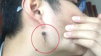 Mọc lông ở 4 vị trí này trên cơ thể càng nhiều thì càng phát tài, phú quý tìm đến, tài lộc đồi dào