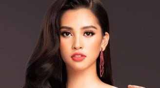 Tiểu Vy lộ đôi chân bầm tím khiến fan lo lắng