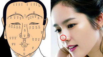 4 nốt ruồi chặn cửa Thần Tài: Ai có 1 cũng nên hóa giải