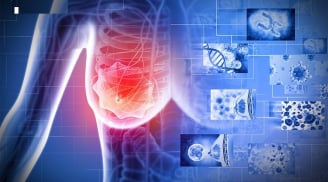 “3 đen” xuất hiện trên cơ thể báo hiệu bệnh K rất gần, gặp bác sĩ ngay