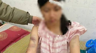 Bà nội cùng hai người đàn ông tra khảo, đánh đập cháu gái 13 tuổi dã man - Lý do gây phẫn nộ