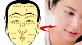 3 nốt ruồi cản trở tài lộc, lận đận tình duyên: Ai có nên tìm cách hóa