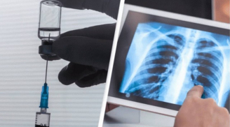 Tin vui: Vắc-xin đầu tiên phòng ung thư phổi chuẩn bị bước vào thử nghiệm lâm sàng năm 2026