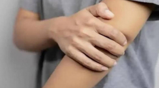 Cảnh báo ung thư: 4 dấu hiệu ở cánh tay tuyệt đối không được bỏ qua – Phát hiện sớm cứu sống bạn