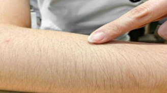 Nơi nào càng mọc nhiều lông càng có lợi cho sức khỏe? Tại sao nhiều người vẫn tẩy sạch, đặc biệt là phái nữ?