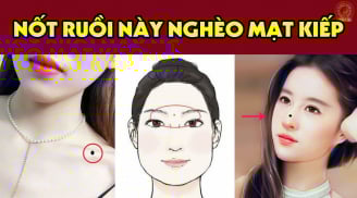 4 nốt ruồi cản trở tài lộc, lận đận tinh duyên: Có 1/4 cũng nên hóa giải