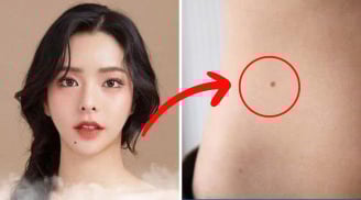 Phụ nữ có 3 nốt ruồi ở vị trí hiếm này: Số mệnh phú quý, viên mãn, tình tiền sáng rực rỡ
