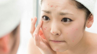 Ghim ngay lịch chăm da 7 ngày giúp da được nuôi dưỡng đúng nhu cầu và duy trì trạng thái khỏe mạnh lâu