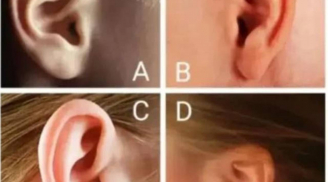 Trắc nghiệm tâm lý: Chọn hình dáng tai giống bạn nhất để biết bạn có giàu sang, may mắn?
