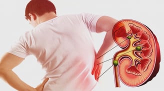 5 dấu hiệu cảnh báo suy thận sớm, nhiều người chủ quan phải chạy thận cả đời