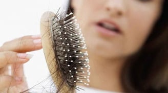 Những thói quen mùa lạnh khiến tình trạng rụng tóc trầm trọng hơn
