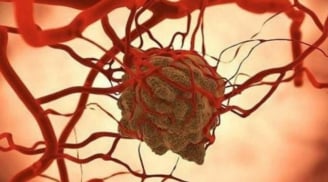 Tế bào ung thư sợ nhất điều gì? Chuyên gia chỉ ra loạt “điểm yếu chí mạng” ngăn chặn và tiêu diệt ung thư