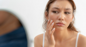 Vì sao đầu gối và khuỷu tay dễ sẫm màu?