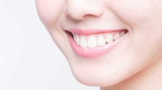 Tẩy trắng răng tại nhà: Cách cải thiện màu răng an toàn cho men răng nhạy cảm
