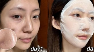 Blogger 28 tuổi dưỡng trắng da, mờ thâm nám nhờ routine khoa học tại nhà