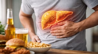 5 Dấu hiệu gan nhiễm mỡ nhưng nhiều người hay bỏ qua