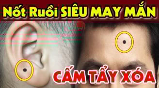 5 nốt ruồi Ông Bà cho Phúc, đời này chỉ lo ăn no ngủ kỹ