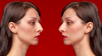 Người có1 trong 4 tướng mạo này cả đời sẽ nghèo khó, không có tiền đồ, hãy nhớ làm nhiều việc thiện tích phước