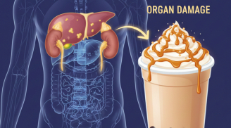 Thức uống được giới trẻ mê mẩn lại là “vua phá gan, thận”: Không phải rượu bia mà hại chẳng kém