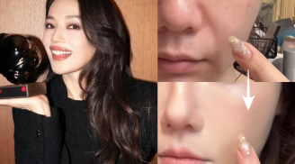 Bí quyết che rãnh cười giúp Thư Kỳ giữ vẻ trẻ trung ở tuổi 50 khiến cộng đồng làm đẹp chú ý