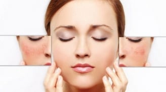 Dưỡng da ở tuổi 30+ cần lưu ý 3 cách làm đẹp tự nhiên này