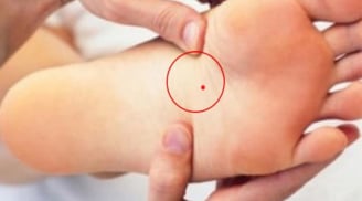 3 nốt ruồi vùng kín cực hút tài lộc: Ai có cả đời sống trong nhung lụa