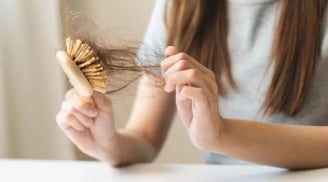 4 vấn đề da đầu âm thầm khiến tóc rụng nhiều hơn và cách xử lý đúng cách