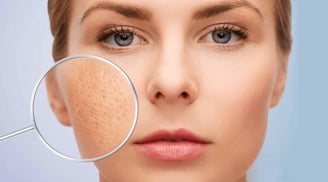 5 cách cải thiện lỗ chân lông to theo bác sĩ da liễu