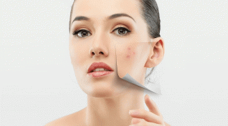 Thanh lọc và phục hồi da tại nhà bằng xông hơi thảo dược kết hợp mặt nạ tự nhiên