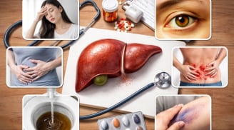 6 dấu hiệu cảnh báo gan suy yếu nhiều người thường bỏ qua, phát hiện sớm để tránh hậu quả nặng