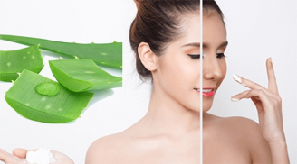 Nha đam và các cách kết hợp hỗ trợ giảm mụn, phục hồi da đúng cách