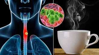 Cảnh báo: Loại nước nhiều người Việt uống mỗi ngày có thể làm tăng gấp 6 lần nguy cơ ung thư