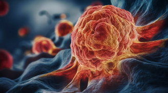 5 dấu hiệu vào buổi tối cảnh báo Ung Thư: Đừng chủ quan kẻo di căn xa