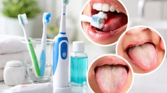 5 dấu hiệu khi đánh răng có thể cảnh báo cơ thể đang gặp vấn đề nguy hiểm, đừng chủ quan