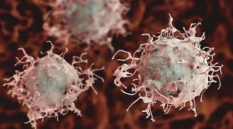 5 biểu hiện vào buổi sáng của người dễ bị ung thư