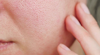 Vì sao lỗ chân lông to và cách chăm sóc da phù hợp cho từng nguyên nhân