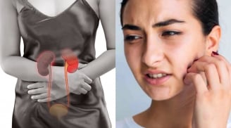 5 dấu hiệu trên mặt cảnh báo suy thận đang âm thầm xảy ra