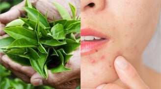 Trà xanh và làn da: lợi ích nổi bật cùng cách sử dụng đúng để hỗ trợ chống lão hóa