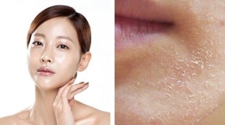 6 dấu hiệu khiến gương mặt trông già hơn tuổi và cách cải thiện hiệu quả