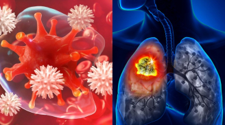 5 loại ung thư phổ biến và nguy hiểm nhất