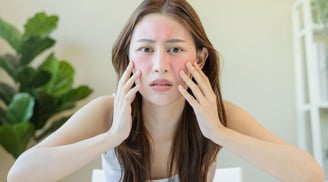 Da chảy xệ: Nguyên nhân và 5 nguyên liệu tự nhiên giúp cải thiện độ săn chắc