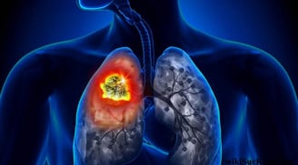 5 dấu hiệu vào buổi tối cảnh báo ung thư: Đặc biệt số 2 rõ ràng mà nhiều người chủ quan